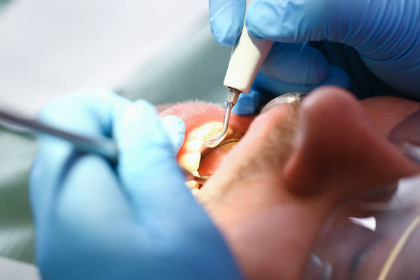 Best Broken or Cracked Tooth Emergency Dentist in Northlakes, NC